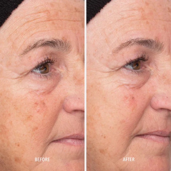 LIQUID RESURFACING SOLUTION - imagine 4