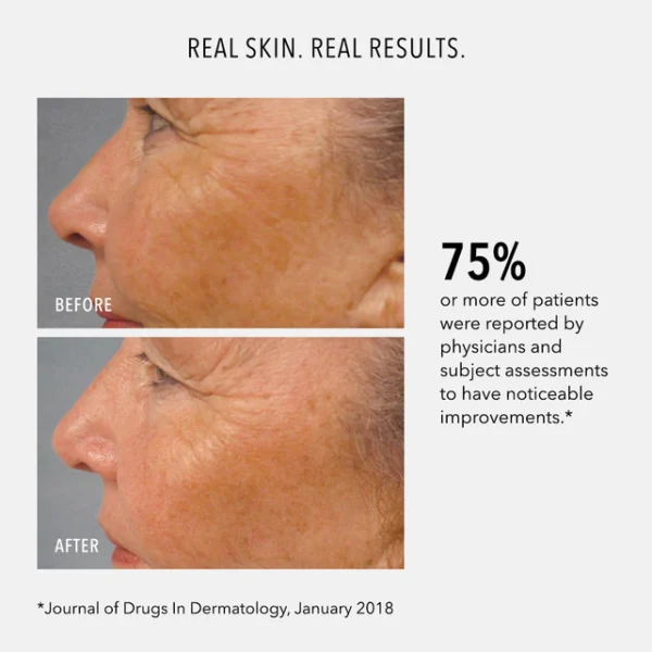 LUMAPRO-C SERUM - imagine 6