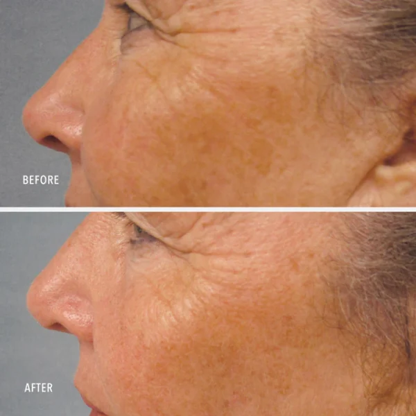 LUMAPRO-C SERUM - imagine 5