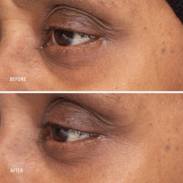 RETINOL EYE RENEWAL - imagine 7