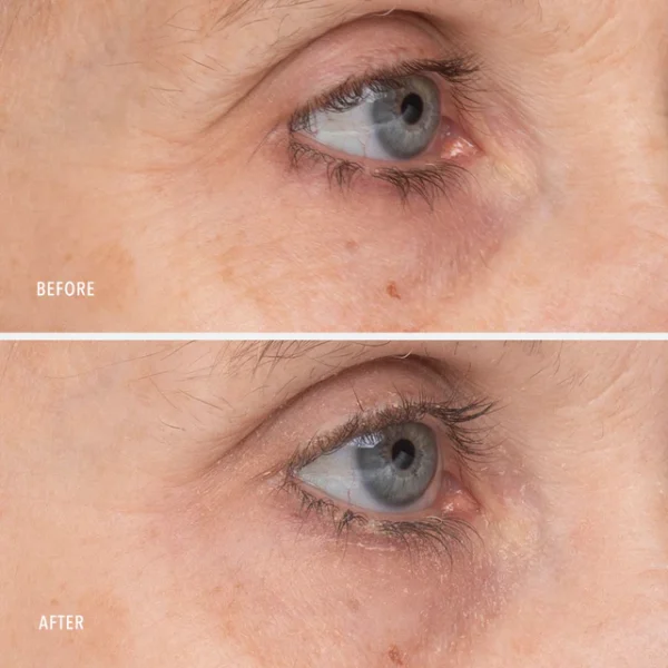 RETINOL EYE RENEWAL - imagine 6