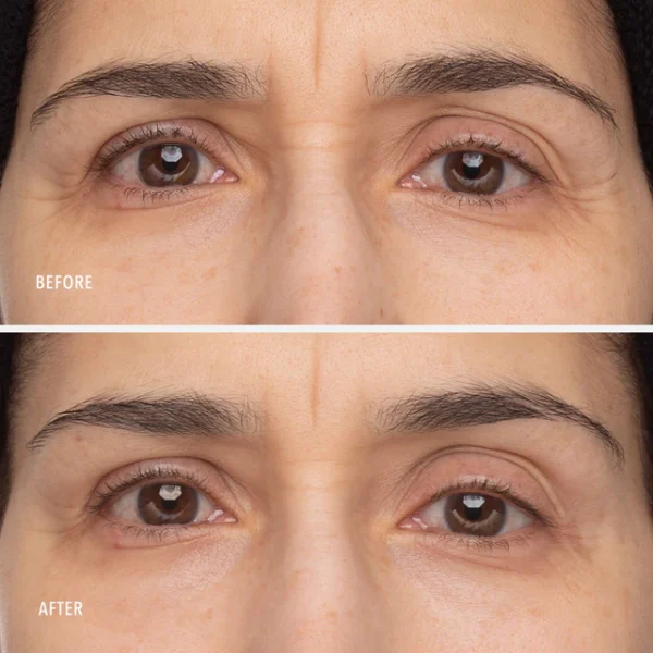 RETINOL EYE RENEWAL - imagine 5