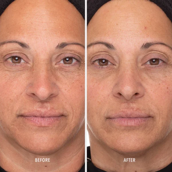 RETINOL ROUTINE BOOSTER - imagine 5