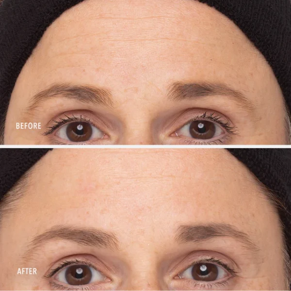 RETINOL ROUTINE BOOSTER - imagine 4